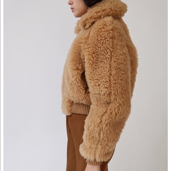 Acne - Picture 7 of 8